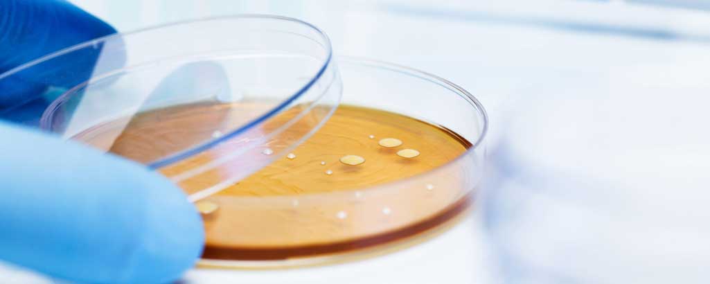 Origen del sistema inmune a través de la microbiota intestinal